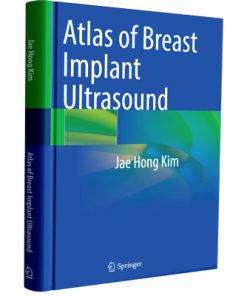 Atlas of Breast Implant Ultrasound