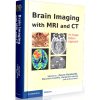 Brain Imaging with MRI and CT: An Image Pattern Approach
