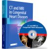 CT and MRI in Congenital Heart Diseases