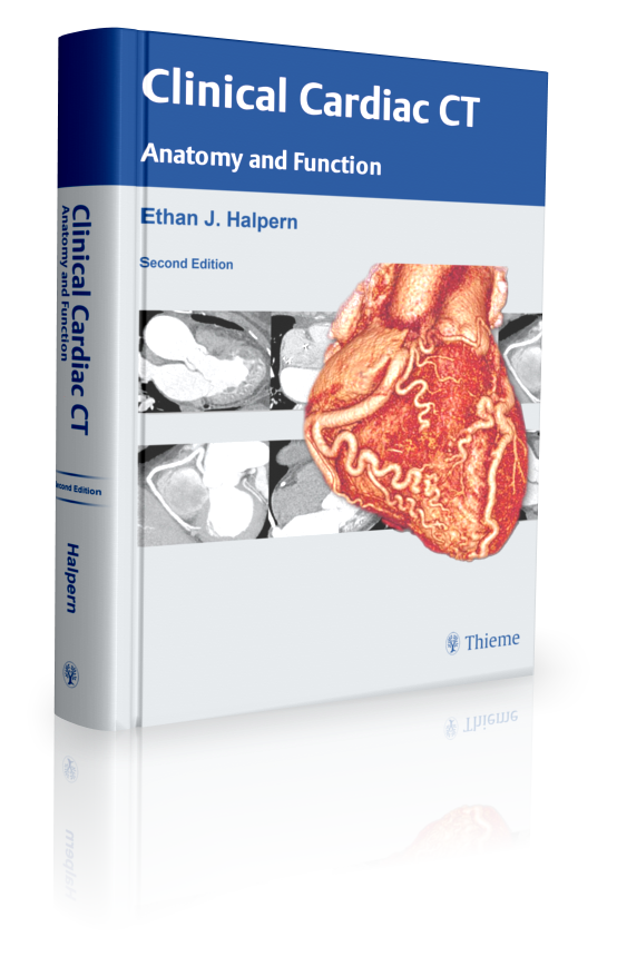 cardiac ct presentation