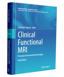 Clinical Functional MRI: Presurgical Functional Neuroimaging
