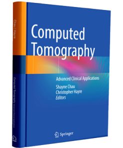 Computed Tomography: Advanced Clinical Applications