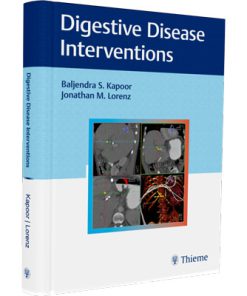 Digestive Disease Interventions