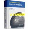 Direct Diagnosis in Radiology: Breast Imaging