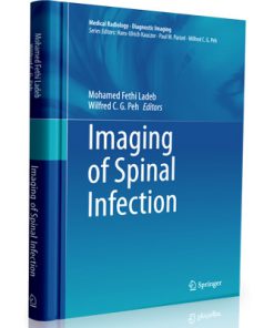 Imaging of Spinal Infection