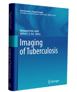 Imaging of Tuberculosis