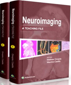 LWW Teaching File Series - Neuroimaging: A Teaching File