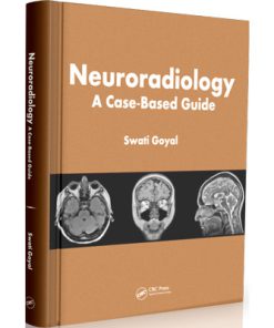 Neuroradiology: A Case-Based Guide