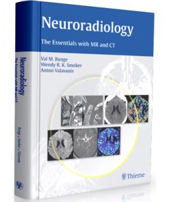 Neuroradiology: The Essentials with MR and CT
