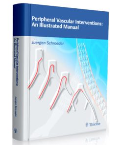 Peripheral Vascular Interventions: An Illustrated Manual