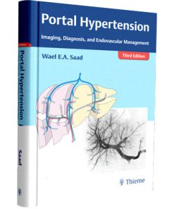 Portal Hypertension: Imaging, Diagnosis, and Endovascular Management