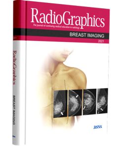 RadioGraphic: Breast Imaging