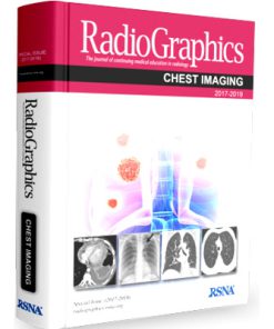 RadioGraphic: Chest Imaging