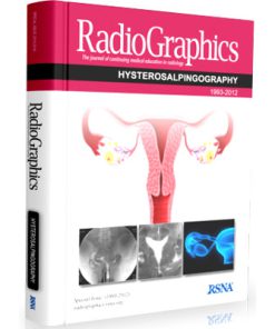 RadioGraphic: Hysterosalpingography