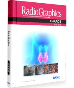 RadioGraphics: TI-RADS