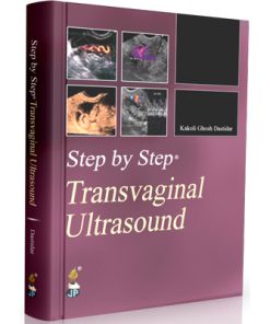Step by Step: Transvaginal Ultrasound