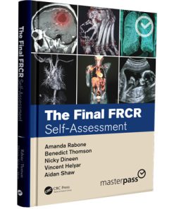 The Final FRCR: Self-Assessment