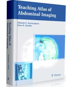 Thieme - Teaching Atlas of Abdominal Imaging
