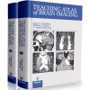 Thieme - Teaching Atlas of Brain Imaging