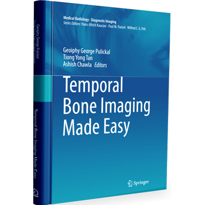 ct temporal bone made easy