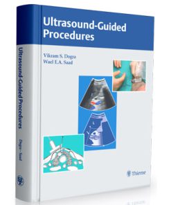 Ultrasound-guided Procedures