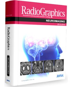 RadioGraphic: Neuroimaging