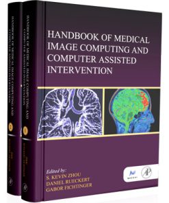 Handbook of Medical Image Computing and Computer Assisted Intervention