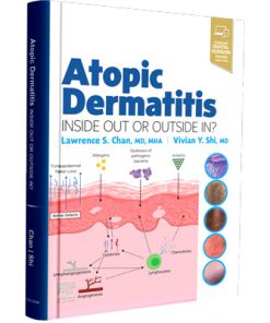?Atopic Dermatitis: Inside Out or Outside In