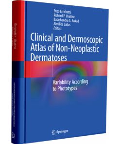Clinical and Dermoscopic Atlas of Non-Neoplastic Dermatoses: Variability According to Phototypes