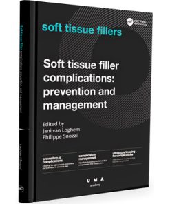 Soft tissue filler complications: prevention and management