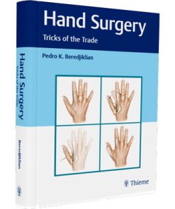 Hand Surgery: Tricks of the Trade