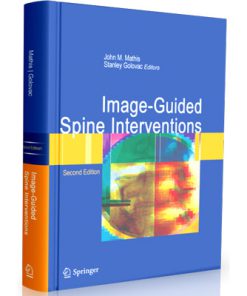 Image guided Spine Interventions