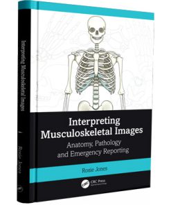 Interpreting-Musculoskeletal-Images