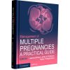 Management of Multiple Pregnancies A Practical Guide