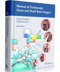 Manual of Endoscopic Sinus and Skull Base Surgery