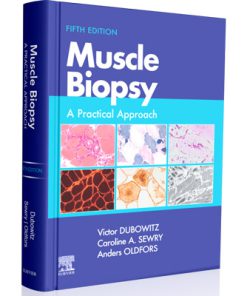 Muscle Biopsy A Practical Approach