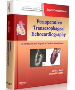 PERIOPERATIVE TRANSESOPHAGEAL : ECHOCARDIOGRAPHY A companion to Kaplans Cardiac Anesthesia