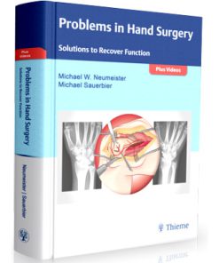Problems in Hand Surgery Solutions to Recover Function