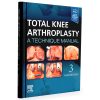Total Knee Arthroplasty, A Technique Manual