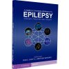 A Complex Systems Approach to Epilepsy Concept, Practice, and Therapy