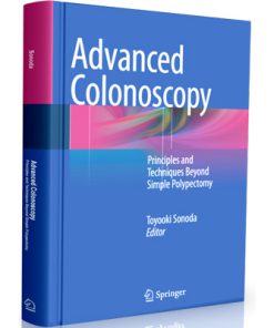 Advanced Colonoscopy: Principles and Techniques Beyond Simple Polypectomy