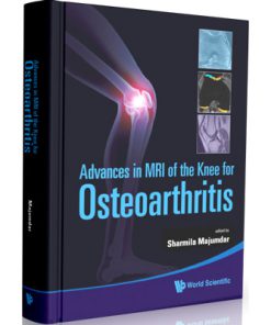 Advances in MRI of the Knee for Osteoarthritis
