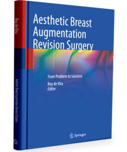 Aesthetic Breast Augmentation Revision Surgery: From Problem to Solution
