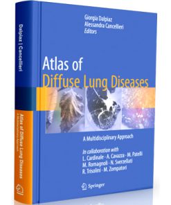 Atlas of Diffuse Lung Diseases - A Multidisciplinary Approach