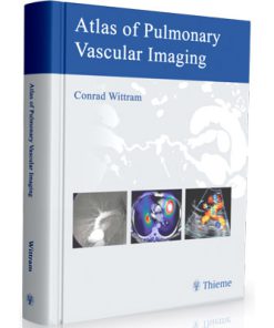 Atlas of Pulmonary Vascular Imaging