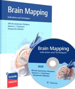 Brain Mapping Indications and Techniques