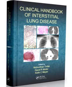 Clinical Handbook of Interstitial Lung Disease