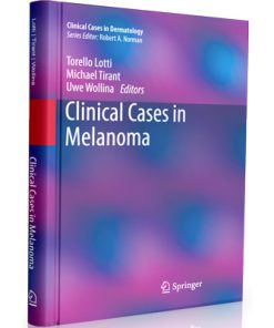 Clinical cases in melanoma - Lotti