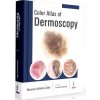 Color Atlas of Dermoscopy
