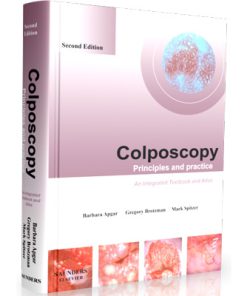 Colposcopy Principles and Practice